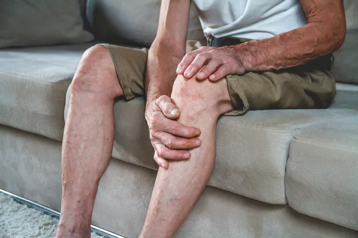 How to Treat Varicose Veins in Men