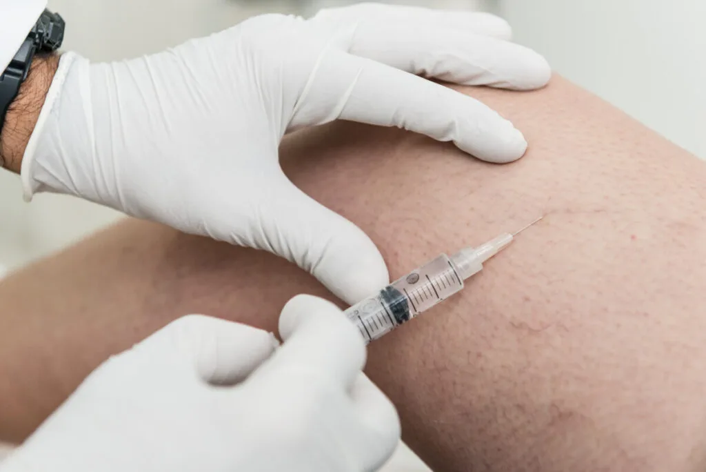 sclerotherapy performed on a persons leg by professional vein doctor