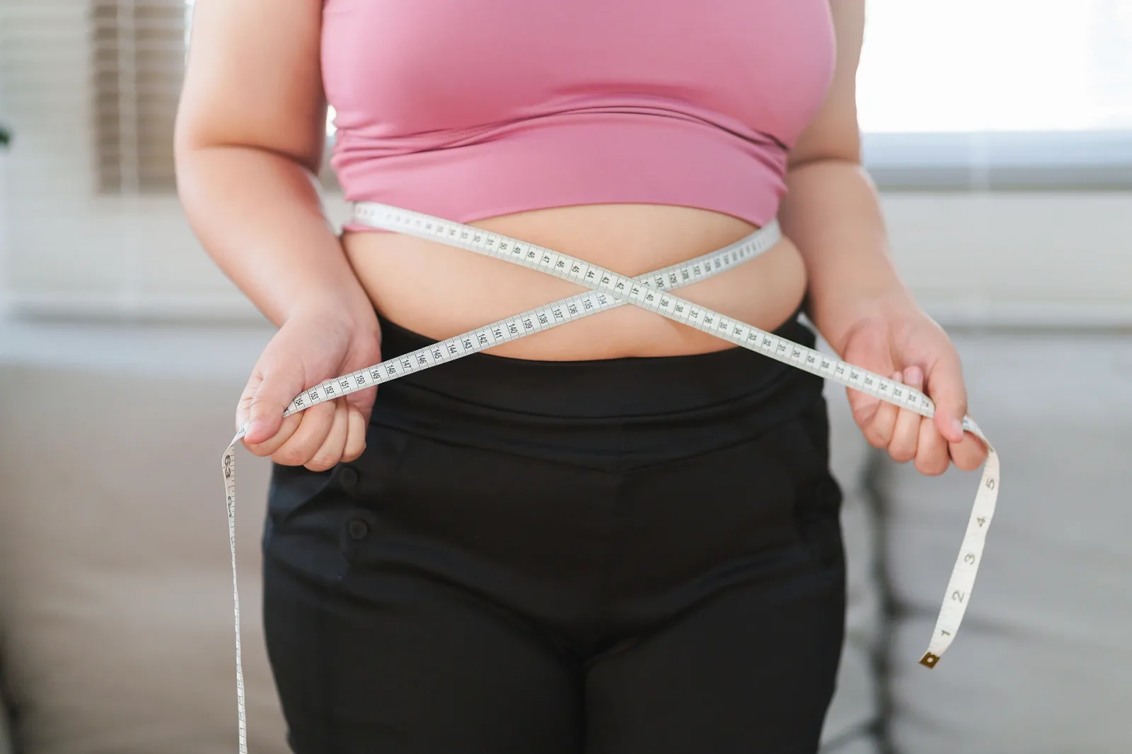 Spider Veins on Chest and Obesity