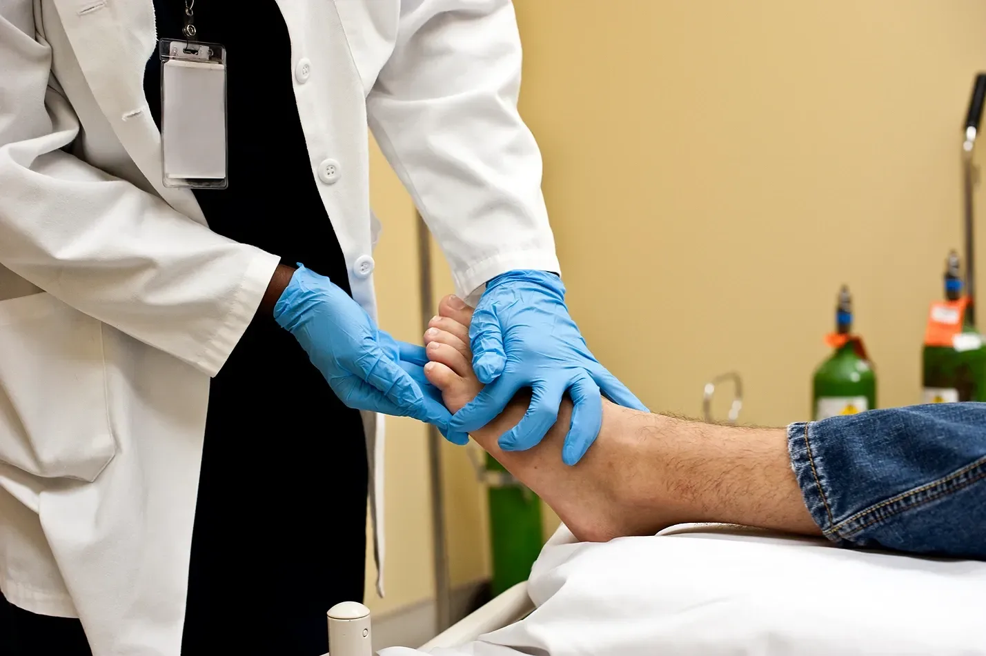 Spider Veins on Feet: Complete Treatment Guide & Prevention