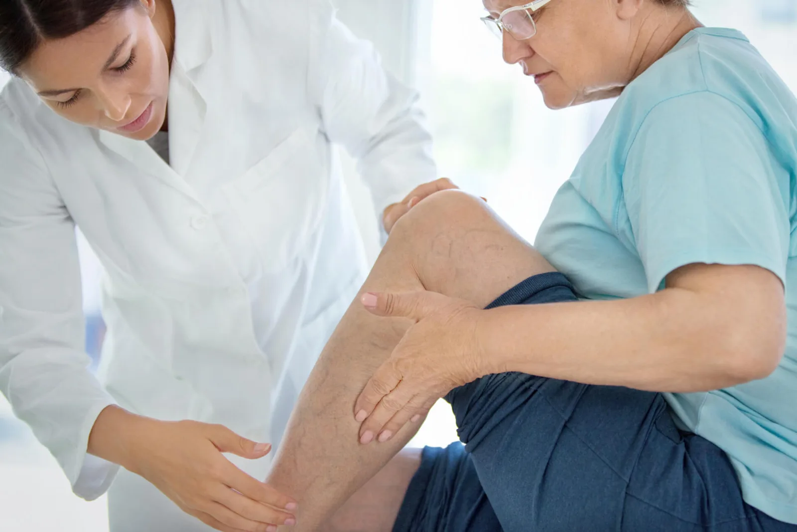 How to Treat Varicose Veins Behind Knees